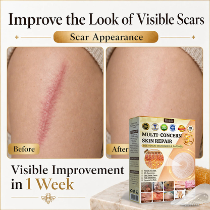 ✨Hiskin ®MULTI-CONCERN SKIN REPAIR BEE VENOM MICRONEEDLE PATCHES