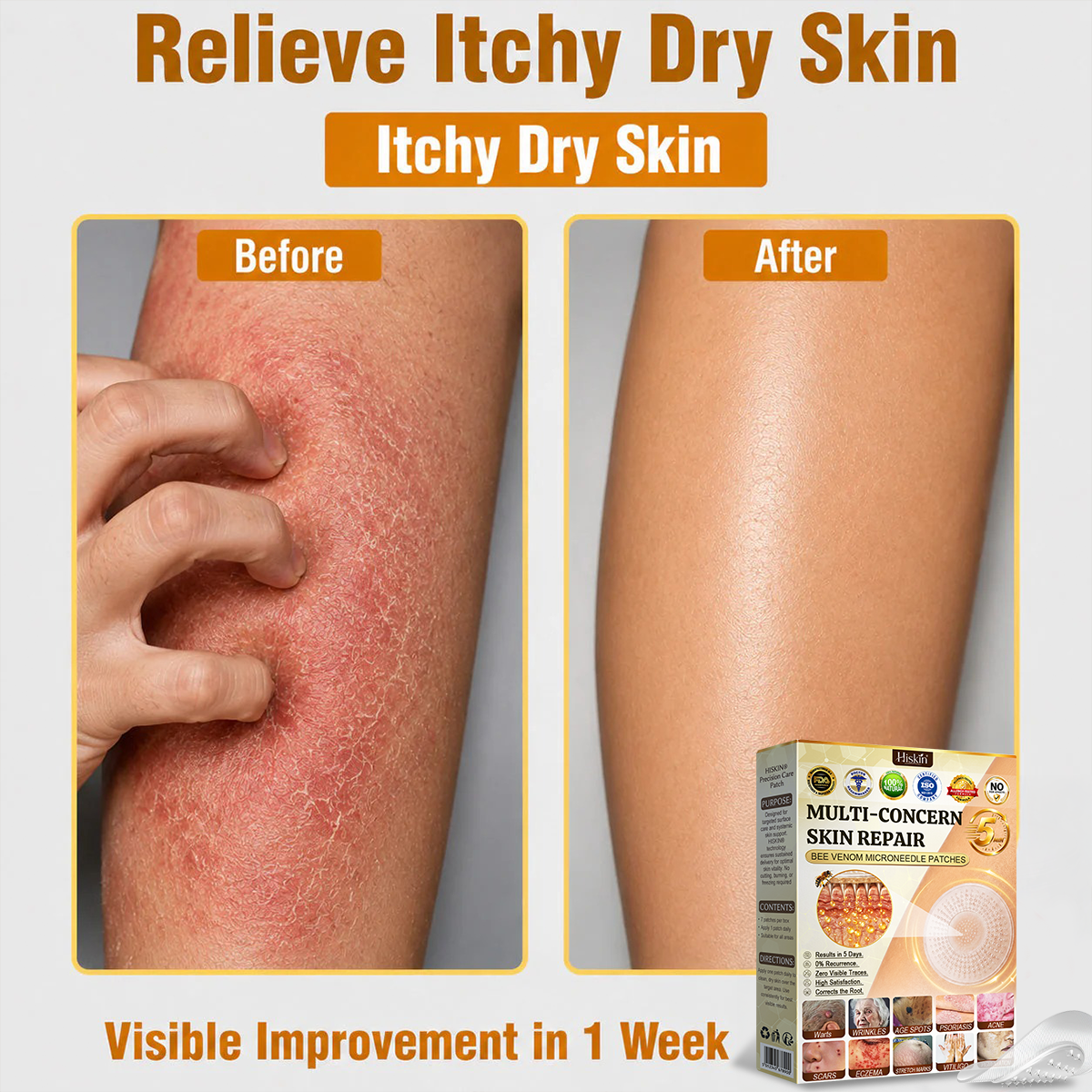 ✨Hiskin ®MULTI-CONCERN SKIN REPAIR BEE VENOM MICRONEEDLE PATCHES