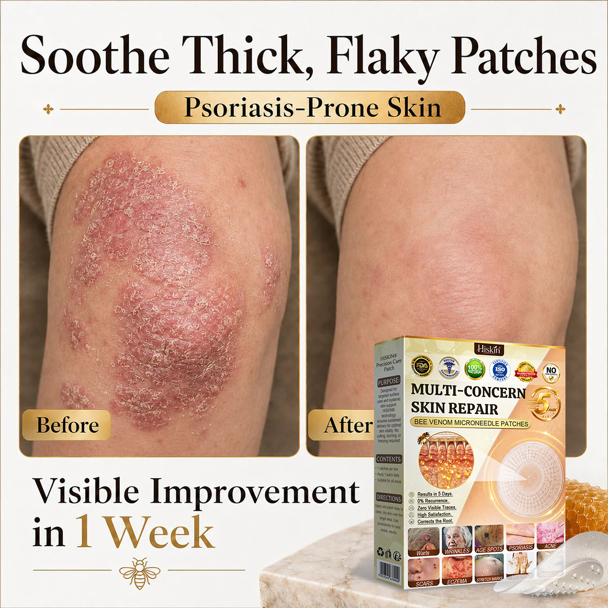 ✨Hiskin ®MULTI-CONCERN SKIN REPAIR BEE VENOM MICRONEEDLE PATCHES