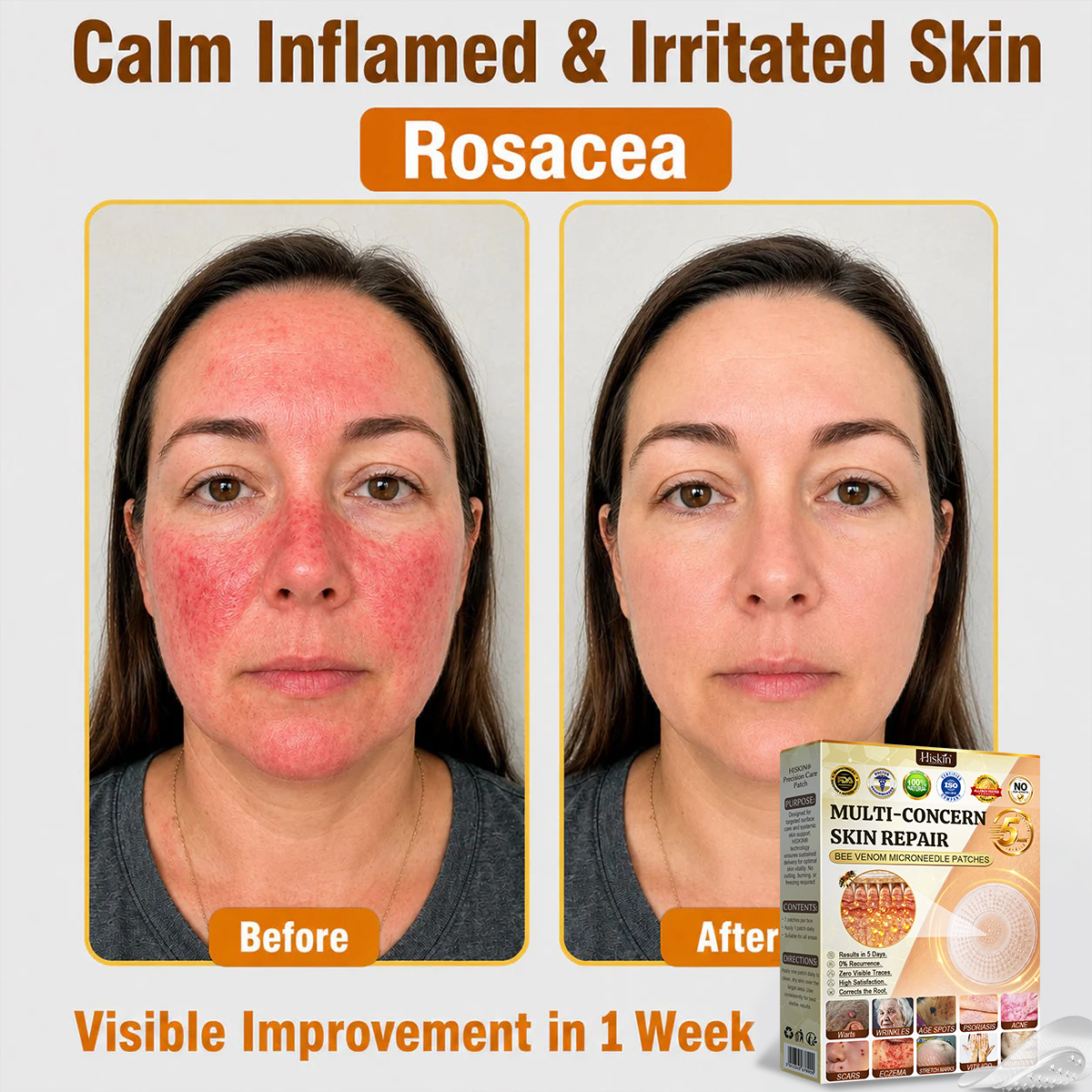 ✨Hiskin ®MULTI-CONCERN SKIN REPAIR BEE VENOM MICRONEEDLE PATCHES