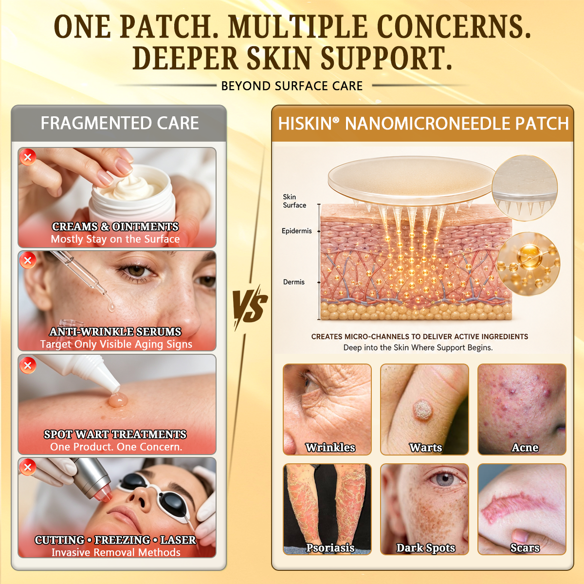 ✨Hiskin ®MULTI-CONCERN SKIN REPAIR BEE VENOM MICRONEEDLE PATCHES