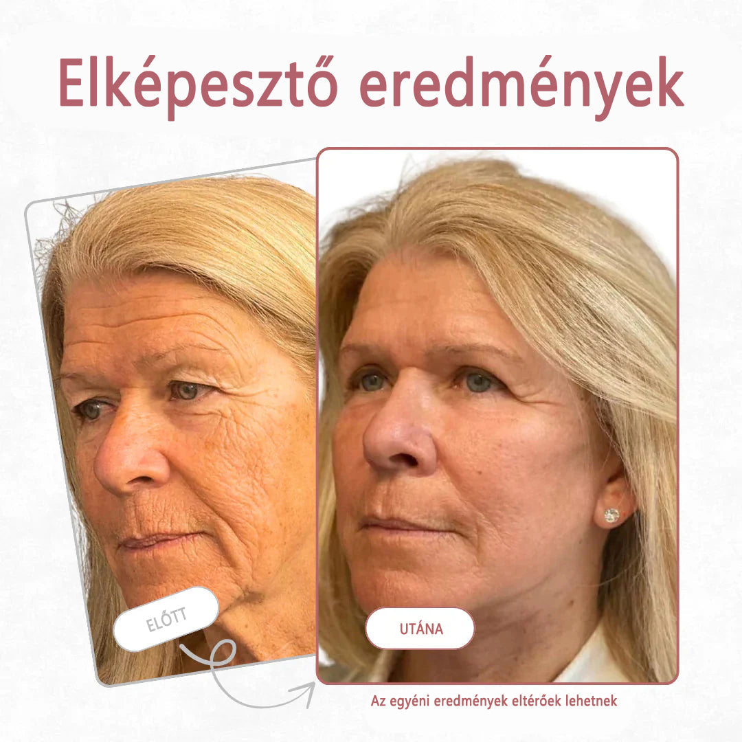 #  1 legjobban eladott termék ✨   Coauoo ® Calcium Eye Multi Effect Cream - Antiaging nedvesítő, megerősítő, nyugtató, emelő, átalakító, ráncok eltávolítása, emelő és fényesítő érett bőr gyors eredményekkel（副本）