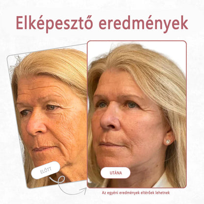 #  1 legjobban eladott termék ✨   Coauoo ® Calcium Eye Multi Effect Cream - Antiaging nedvesítő, megerősítő, nyugtató, emelő, átalakító, ráncok eltávolítása, emelő és fényesítő érett bőr gyors eredményekkel（副本）