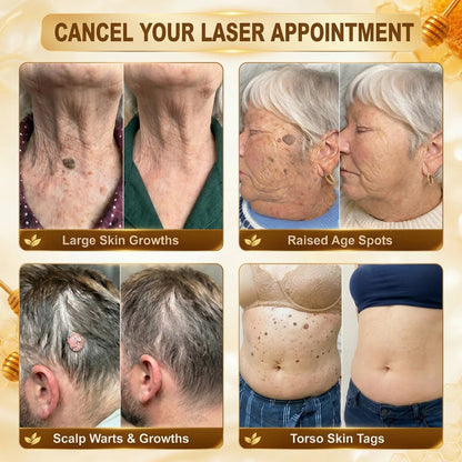 ✨Hiskin ®MULTI-CONCERN SKIN REPAIR BEE VENOM MICRONEEDLE PATCHES